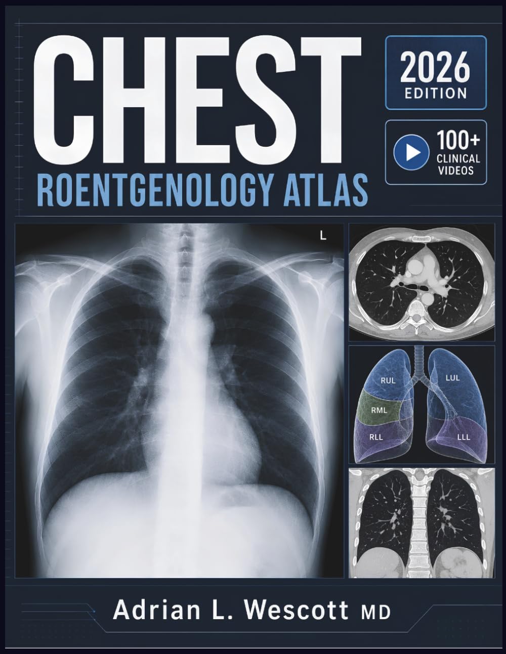 CHEST ROENTGENOLOGY ATLAS: Systematic Image Interpretation, Differential Diagnosis of Pulmonary Findings, and Evidence-Based Decision Support for Radiology Residents and Clinicians