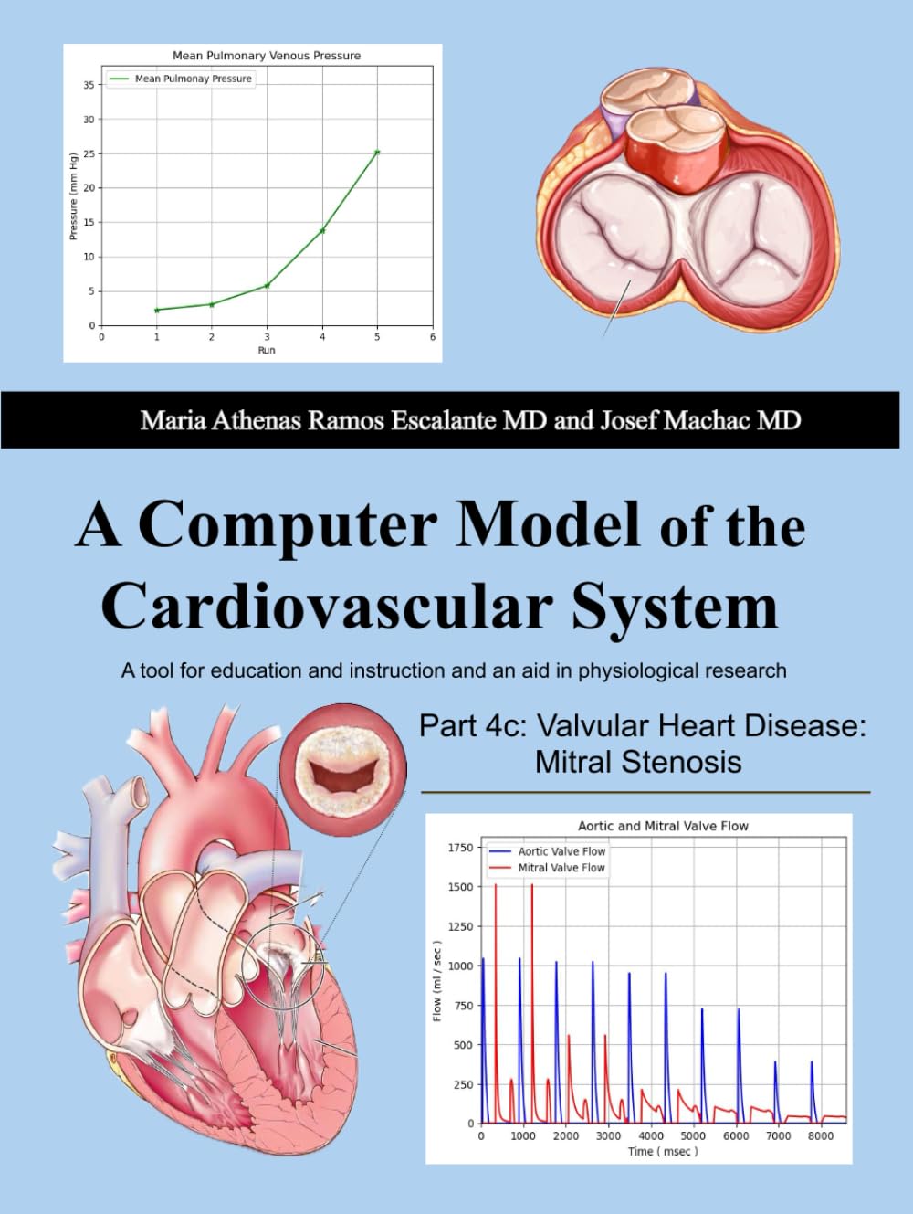 A Computer Model of the Cardiovascular System: A Tool for Education and Instruction and An Aid in Physiological Research: Part 4c: Valvular Heart Disease: Mitral Stenosis