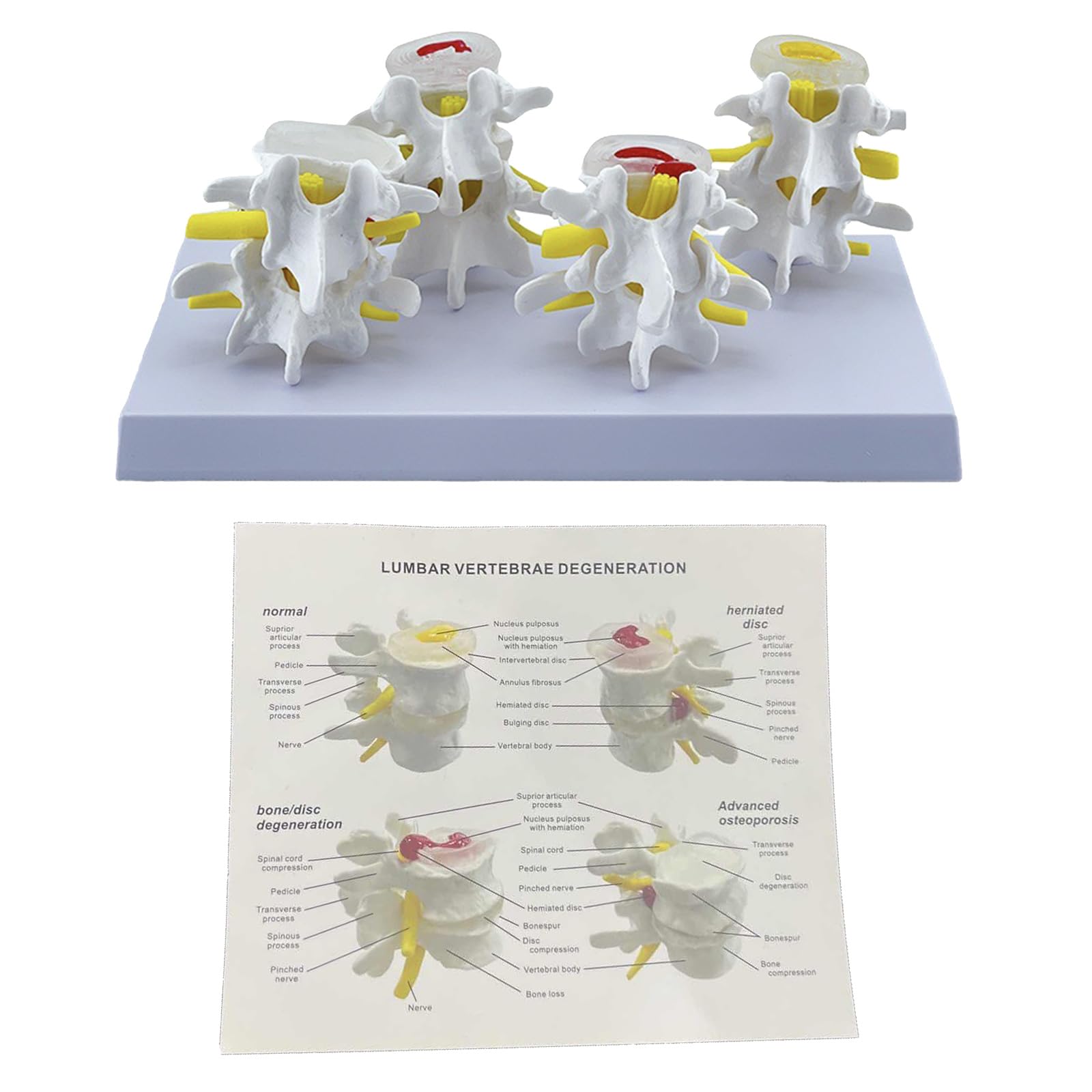 XuQiZZpp Human Lumbar Vertebrae Model Medicals Teaching Tool Human Lumbar Spine Anatomy Model School Teaching Supplies