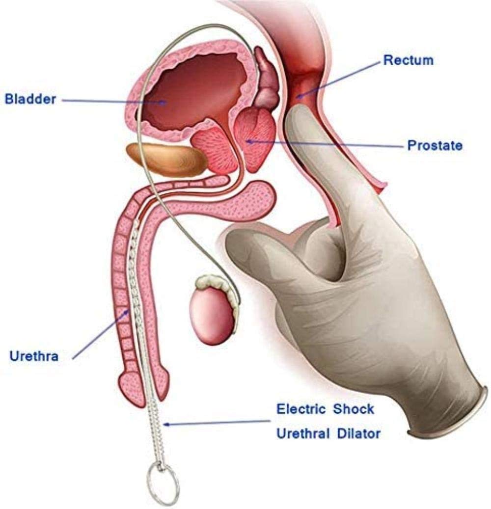 EBXH Male Erotic Elektroschock Orgasmus Masturbation Gert Edelstahl  Harnrhren Dilator Stimulation Stecker Lengthening,A,D : Amazon.de:  Drogerie & Krperpflege