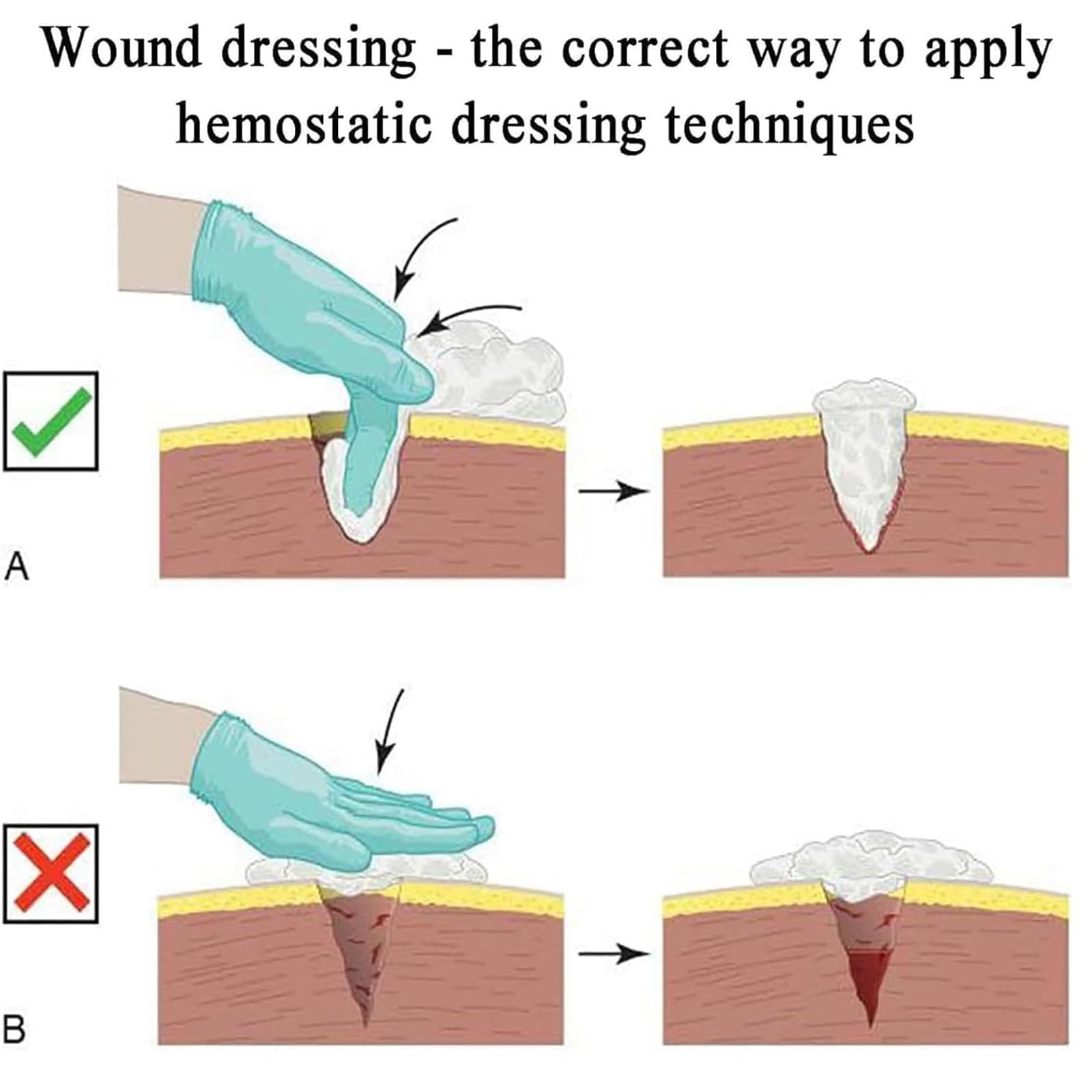 Trainer 2 in 1 per il controllo delle emorragie e la medicazione delle ferite – Kit di formazione realistico per fermare le emorragie per la pratica delle cure di emergenza,Flesh