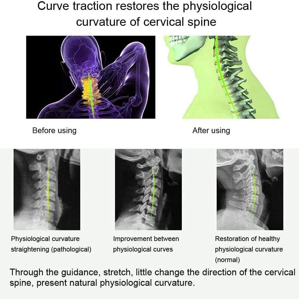 Supporto per Il Collo per Il Dolore al Collo Trazione cervicale Sollievo dal Dolore Cura Strumenti di Recupero Barella riscaldata Riparazione correttiva Bretelle razionali per Il s