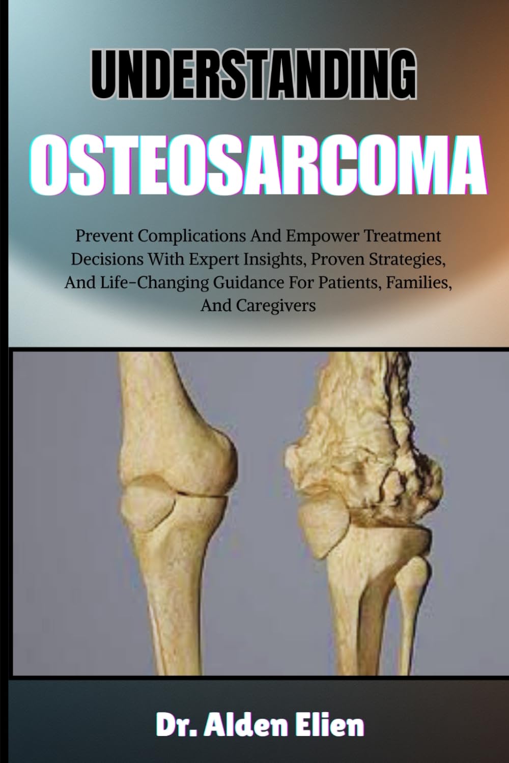 UNDERSTANDING OSTEOSARCOMA: Prevent Complications And Empower Treatment Decisions With Expert Insights, Proven Strategies, And Life-Changing Guidance For Patients, Families, And Caregivers