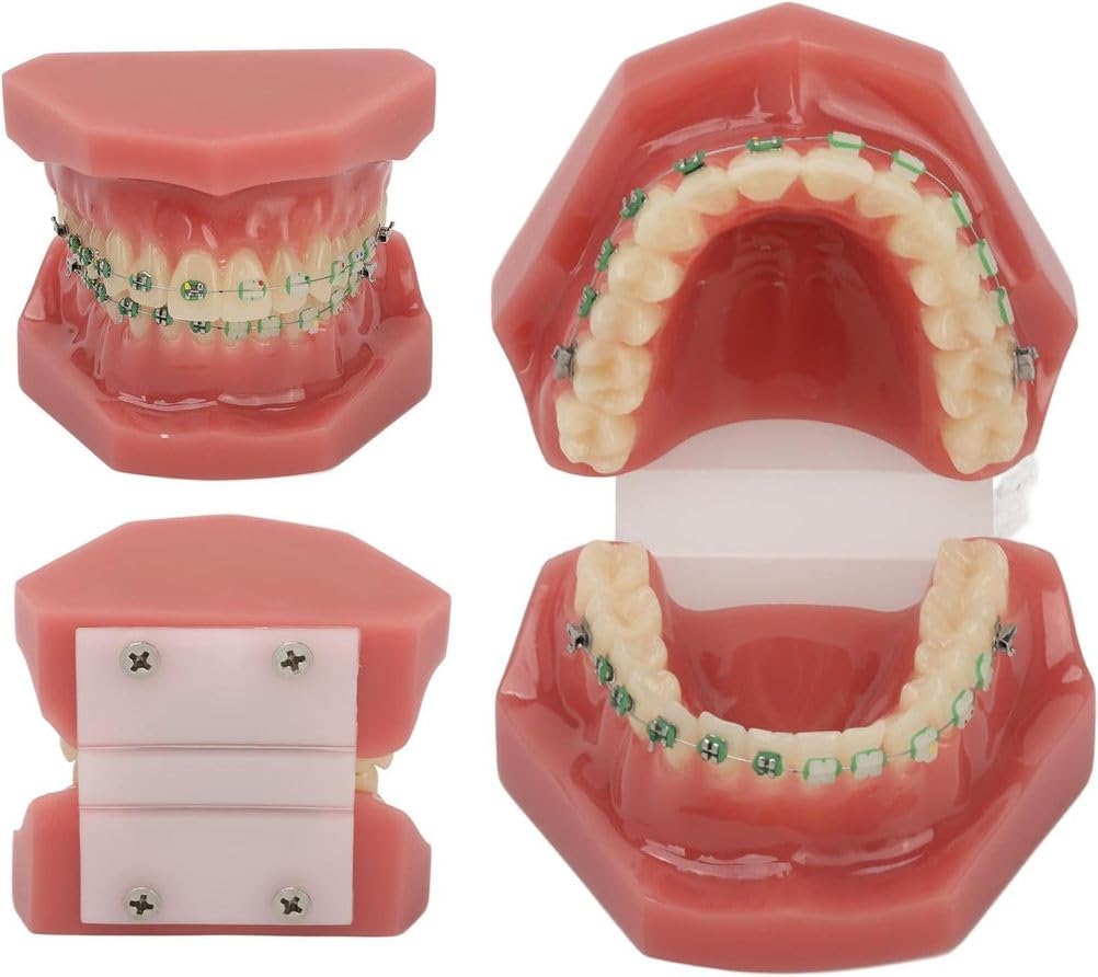 Modello di Ortodonzia Dentale,Modello di Ortodonzia Dentale in Resina,Modello di Ortodonzia Dentale Modello Dentale con Supporto di Fili Metallici per L'insegnamento