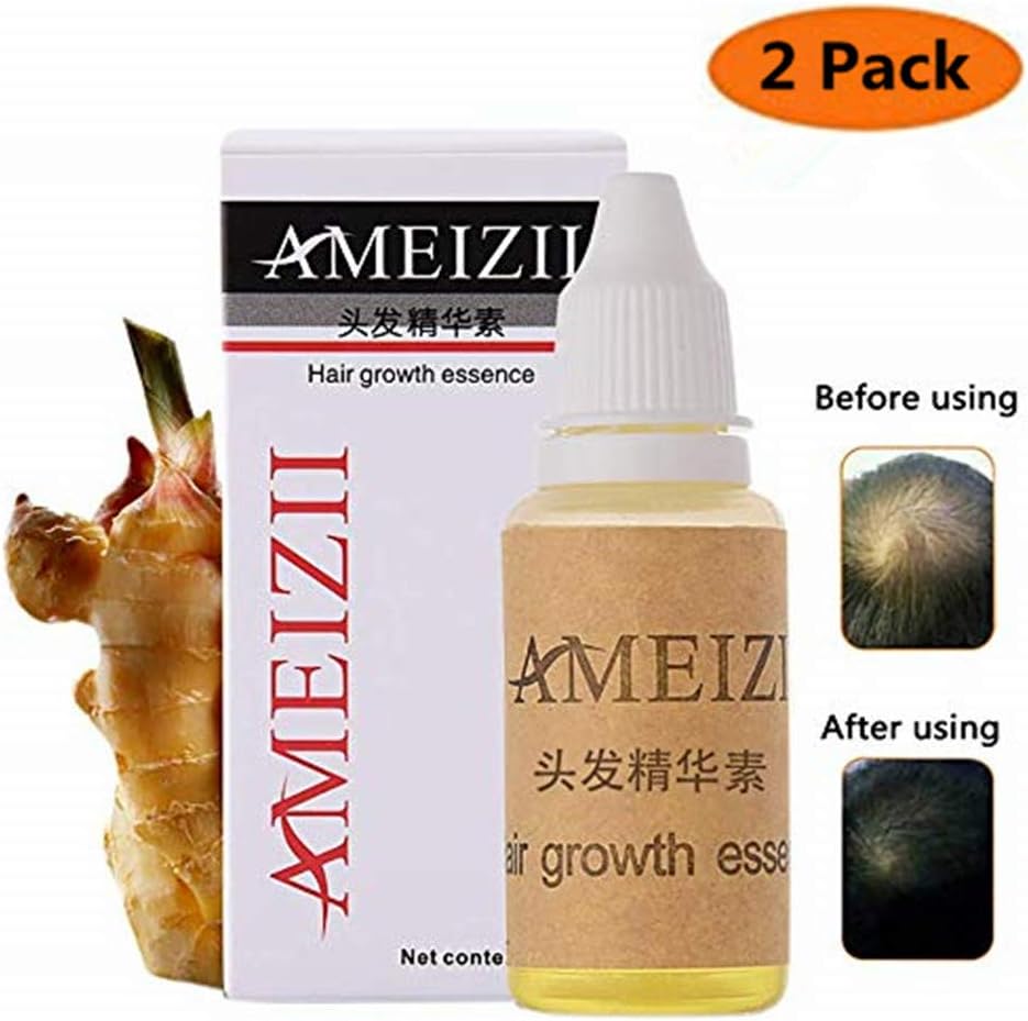 Hair Growth Serum,2019 Hair Regrowth Treatment, Hair Serum,Hair Growth Oil, Hair Growth Essence, Hair Loss Treatments, Prevent Hair Loss, Thinning Hair for Women Men (Pack of 2)