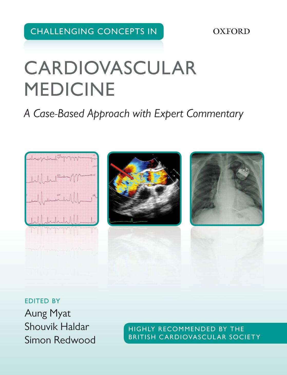 Challenging Concepts in Cardiovascular Medicine: Cases with Expe