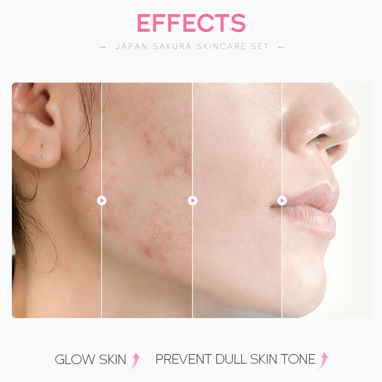 Japan Sakura zestaw do pielęgnacji skóry dla nastolatek i dziewcząt – Sakura Skin Care, zestaw do pielęgnacji twarzy, nawilżający zestaw upominkowy dla kobiet – z maską błotną, serum, kremem, kremem