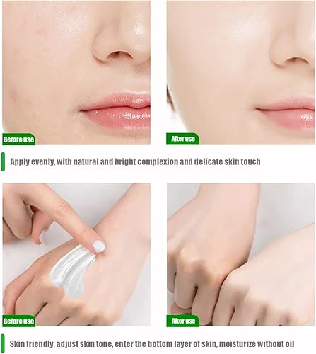 Miniatura 3 de Crema blanqueadora íntima para mujer, removedor de manchas oscuras para cara, cuerpo y áreas sensibles, cuidado natural de la piel para axilas,