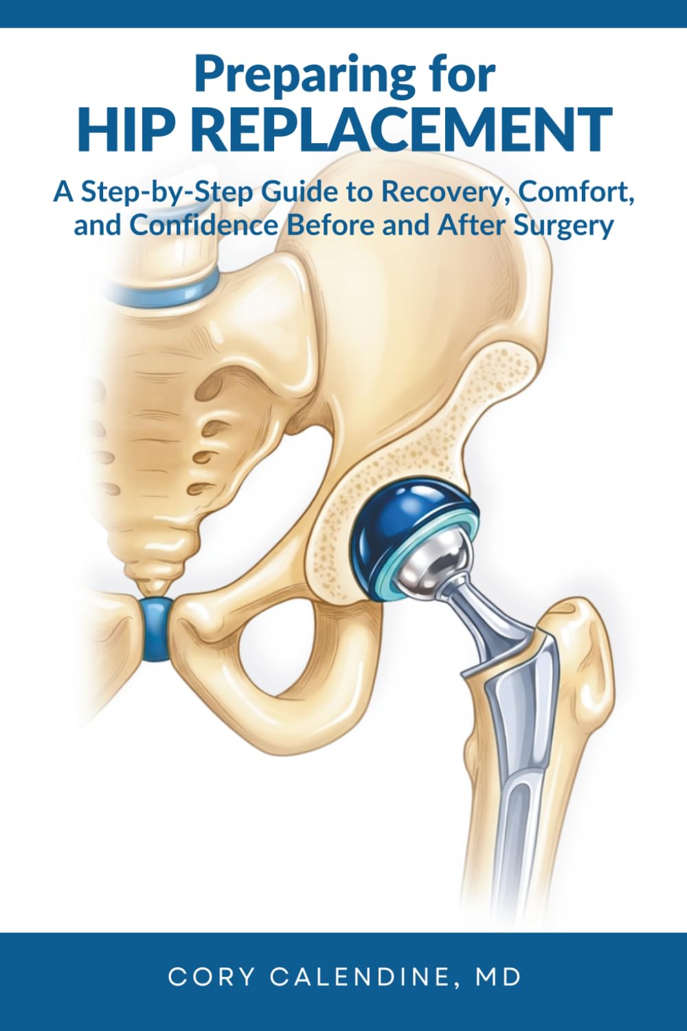 Preparing for Hip Replacement: Your Complete Guide to Faster Recovery, Better Outcomes, and a Stronger Return to Living
