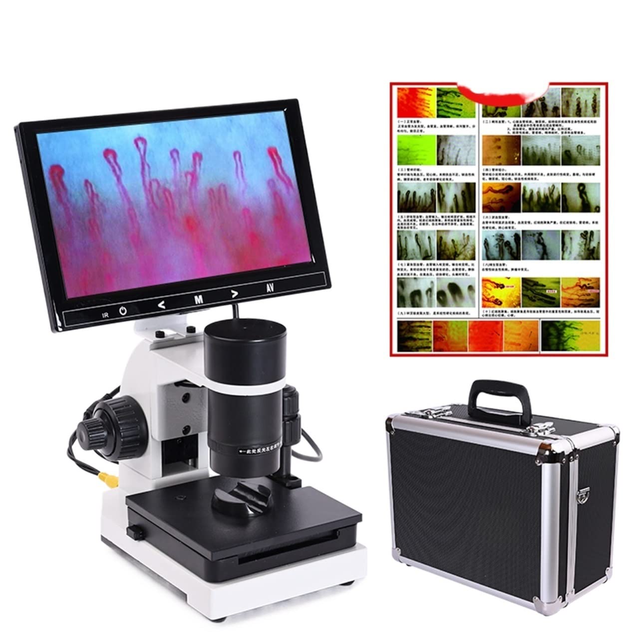 Microscopio, Profesional Nailfold Microcirculación capilar USB HD Microscopio Digital Sangre + Pantalla LCD a Color de 7 "o 9"(7inch LCD Screen)
