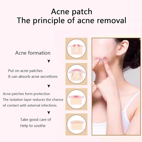 pimple patches 240pc Hydrocolloid Acne Spot Treatment Patch for Early Stage Zits and Hidden Pimples