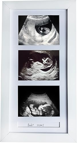 trlry Marcos de fotos de triple ultrasonido, marco de fotos de Sonogram 3 fotos, anuncios de embarazo, regalos de embarazo para madres primerizas,