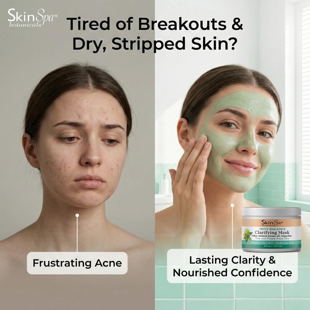 Face Mask - Acne Control Mint Julep Masque with Hyaluronic Acid, Vitamin B & E - Lock In Moisture, Cleanse & Refresh Oily, Pimple-Prone Skin - 8 oz