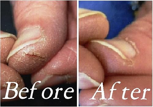 Miniatura 2 de HerillaFingerHydration