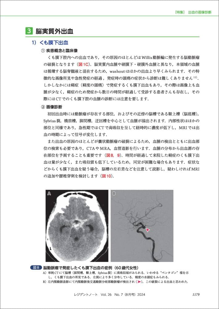 【kazuさま専用】レジデントノート8冊セット レジデントノート 2024年8月 Vol.26 No.7 頭部CT・MRI キホン