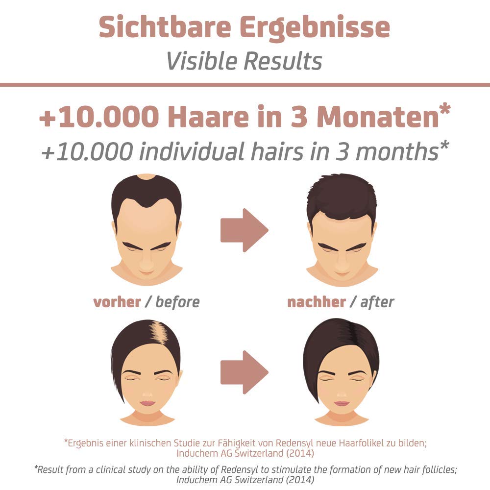 GoMo ENERGY – Hair Activity Tonic unterstützt das Haarwachstum – prämierter Wirkstoffkomplex mit 3% REDENSYL in Kombination mit Koffein, Ginseng Extrakt, Provitamim B5 & Zink – Swiss Made (150ml)