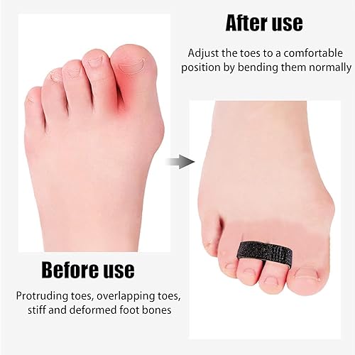 Miniatura 3 de Yxmeiguo Paquete de 10 cintas adhesivas para dedos, férulas antideslizantes para dedos rotos, con velcro acolchado, lavable y reutilizable, para