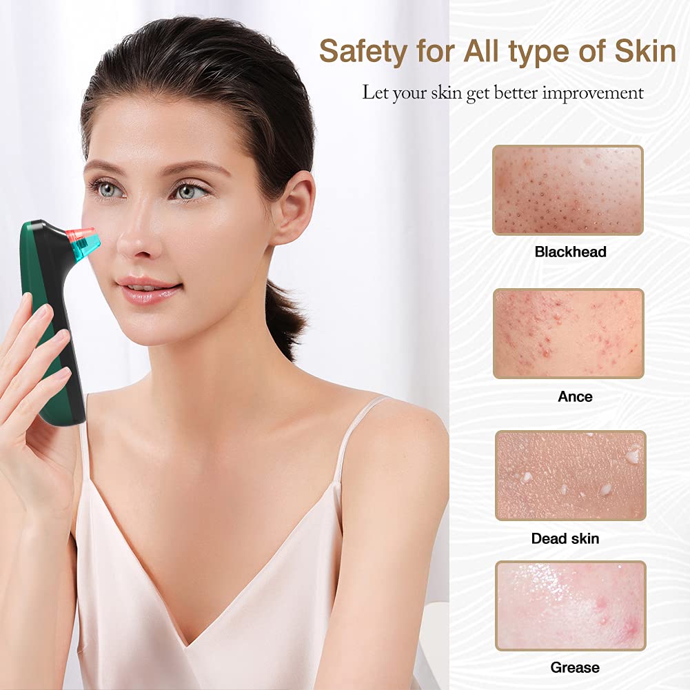 Estrattore di punti neri per la rimozione di punti neri per il viso elettrico per la pulizia profonda con pulizia rossa e blu, 5 livelli di aspirazione, ricaricabile tramite USB