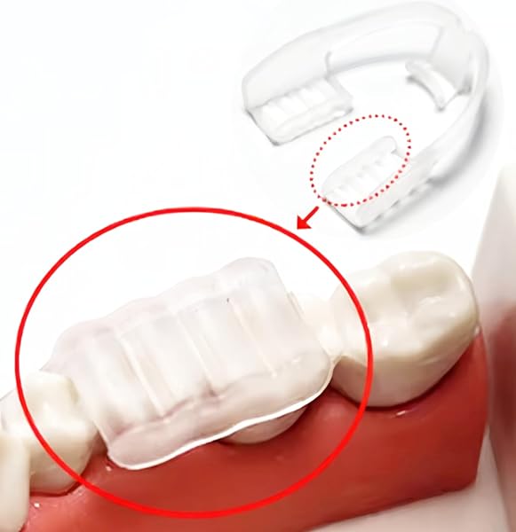 Paradenti Termoformabile Monopezzo – Protezione Denti Incisivi e Molari – Boil & Bite – Comfort e Stabilità – Adulto - 3