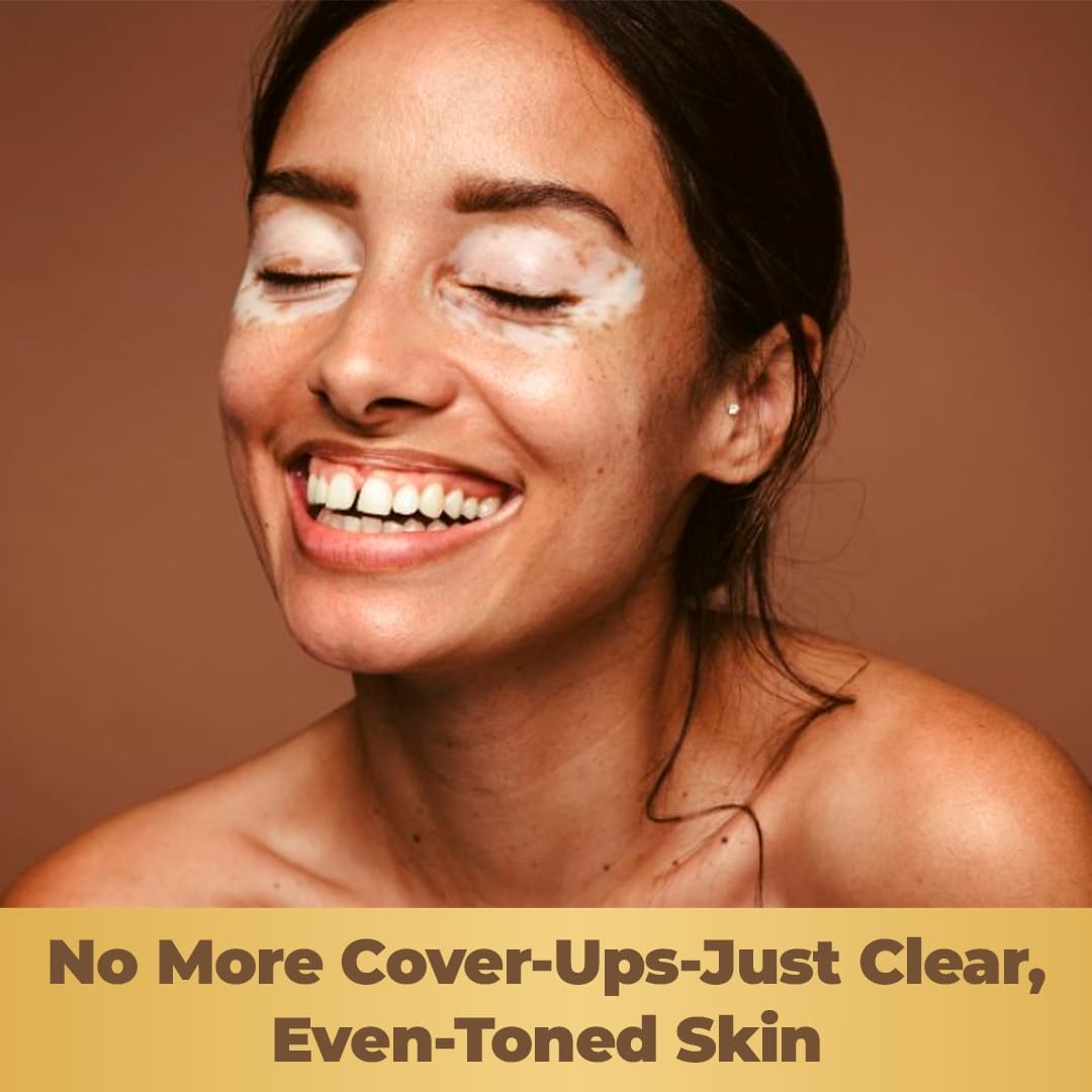 Dermawonder Vitiligo Capsules (60 Count) Effective Vitiligo Supplement, Reduce White Spots & Improve Skin Pigmentation Support, for All Skin & Reduce White Spots on Skin and Tinted Skin