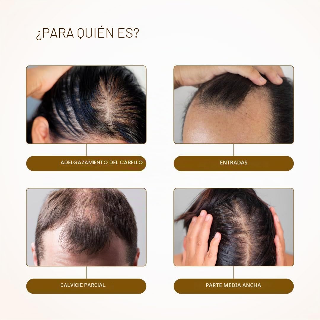 Bare Anatomy Advanced suero para el crecimiento del cabello Roll-On | 3% redensyl + 4% anagain + 2% Baicapil + 5% romero, agua de arroz, biotina y palma enana americana | 25 ml