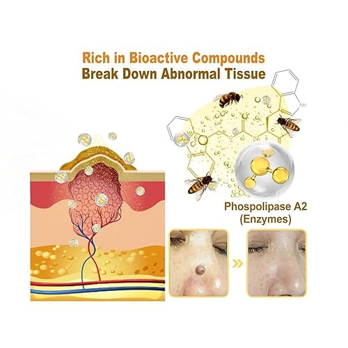 Miniatura 6 de Spray de tratamiento de veneno de abeja elimina manchas para hombres y mujeres, aerosol de decoloración de veneno de abeja, aerosol para la piel de