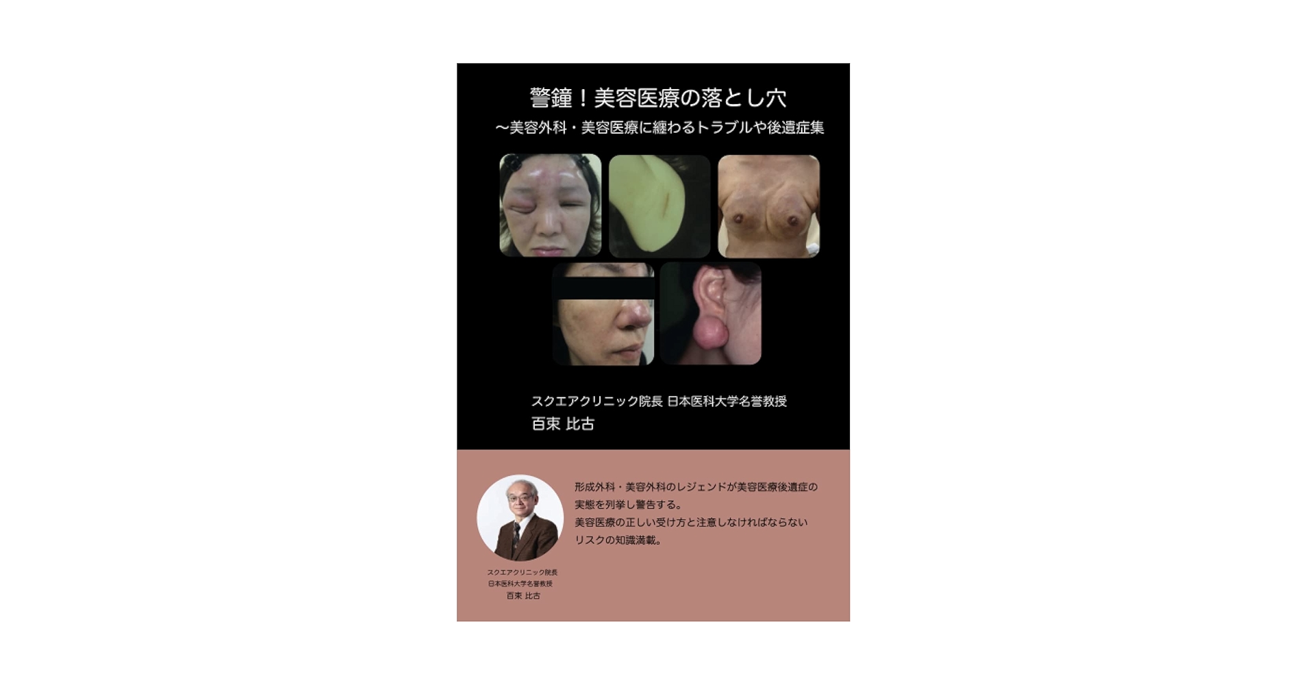 Amazon.co.jp: 警鐘！美容医療の落とし穴: 〜美容外科・美容医療