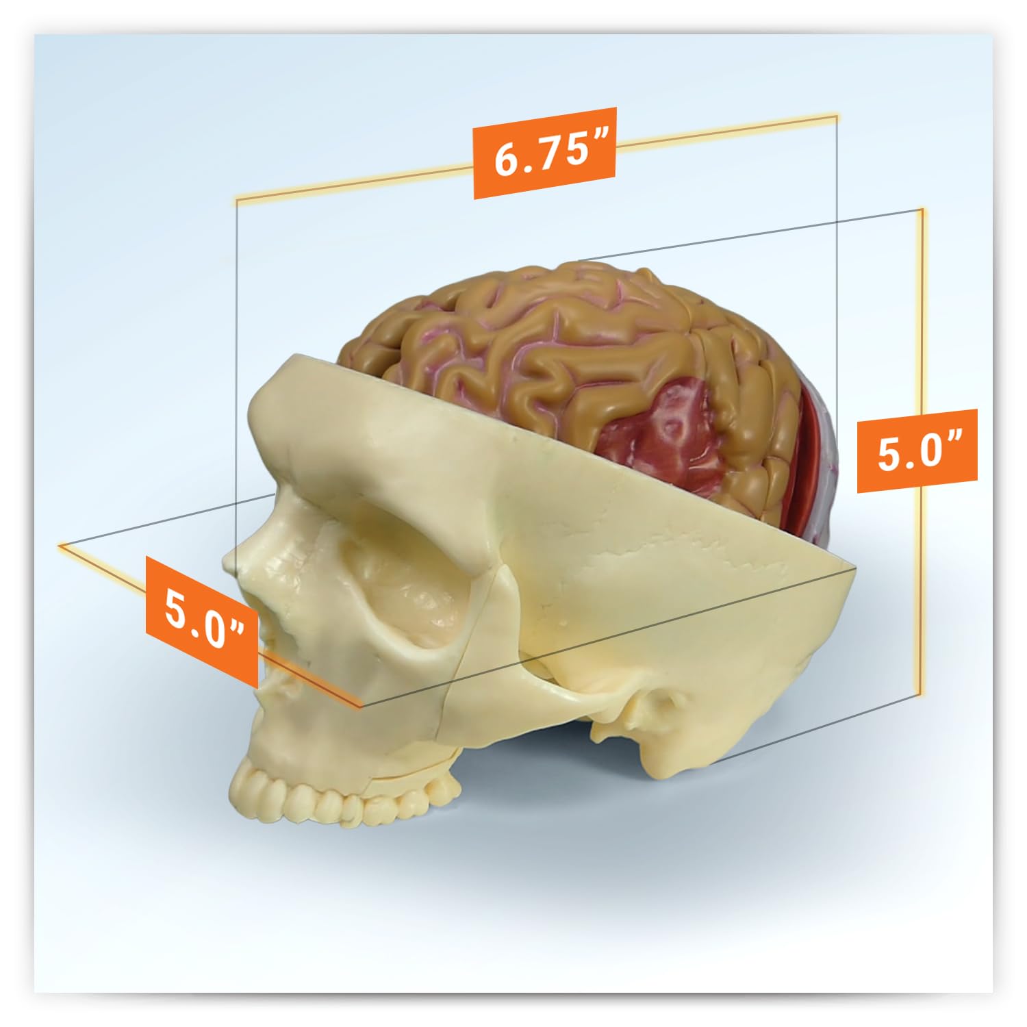 Amazon.co.jp: GPI Anatomicals - 脳モデル 人体解剖学のための病理学