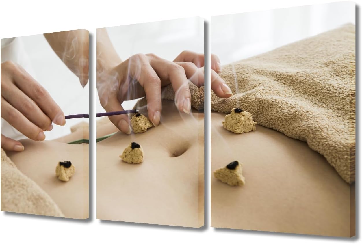 Moxa Moxibustion Prints for Wall Decor Moxibustion Framed Wall Art Posters & Prints 3 Panels Nosocomium Paintings Giclee Print Gallery Packaging Artwork (36" Wx24 H)