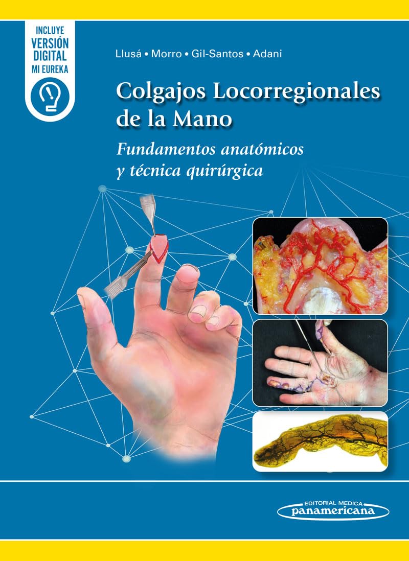 Colgajos Locorregionales de la Mano: Fundamentos anatómicos y técnica quirúrgica