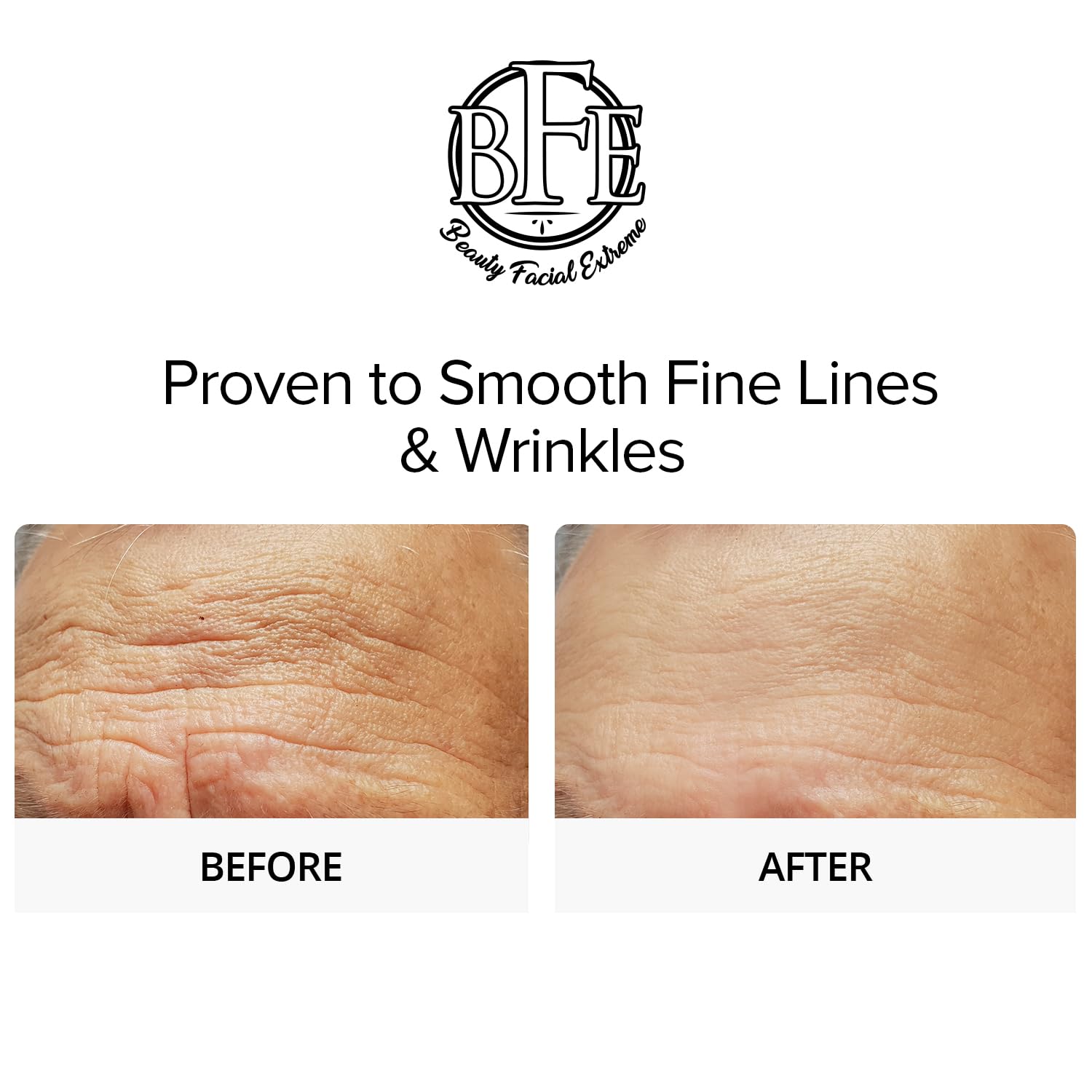 Glycolic Acid 15% Anti-Wrinkle Cream- Extra strength Alpha Hydroxy Acid Enhanced with Green Tea Extract. Improves Complexion & Smooths Out Fine Lines & Wrinkles - Image 3