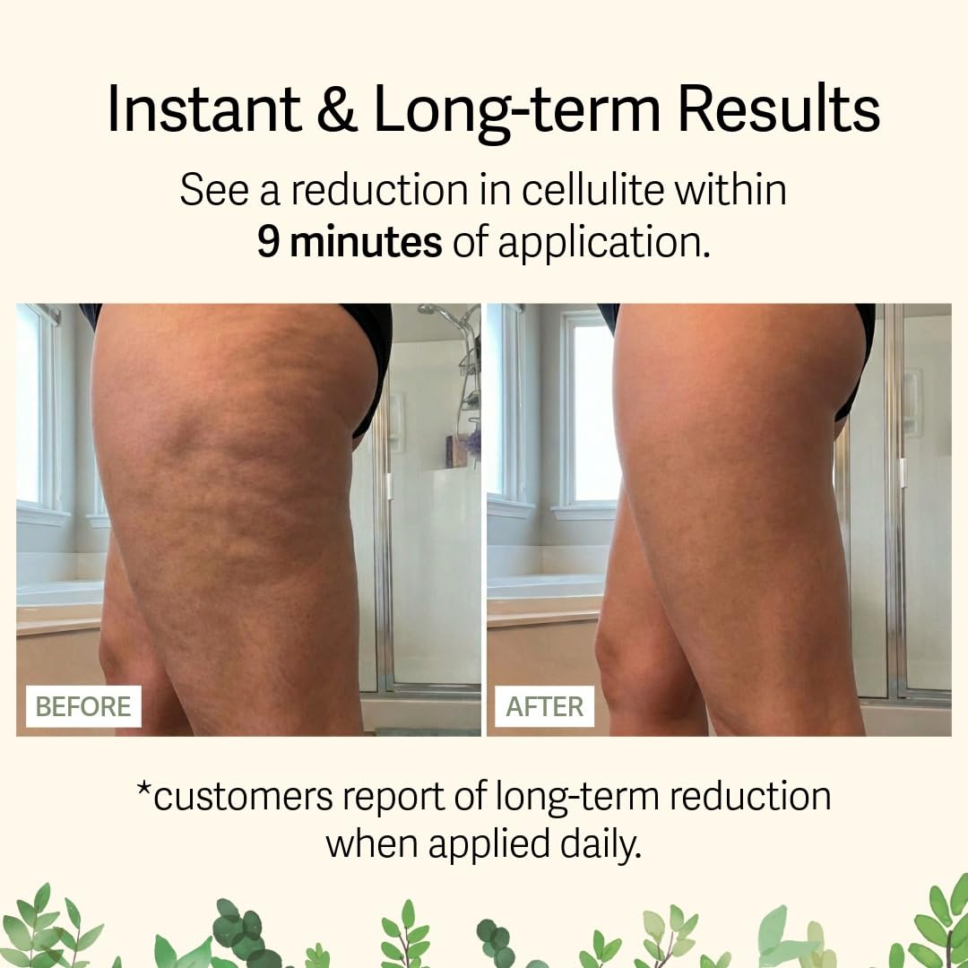 Anti Cellulite アンチセルライト ソマトリン コスメティック】アンチセルライト・サーモアクティブ
