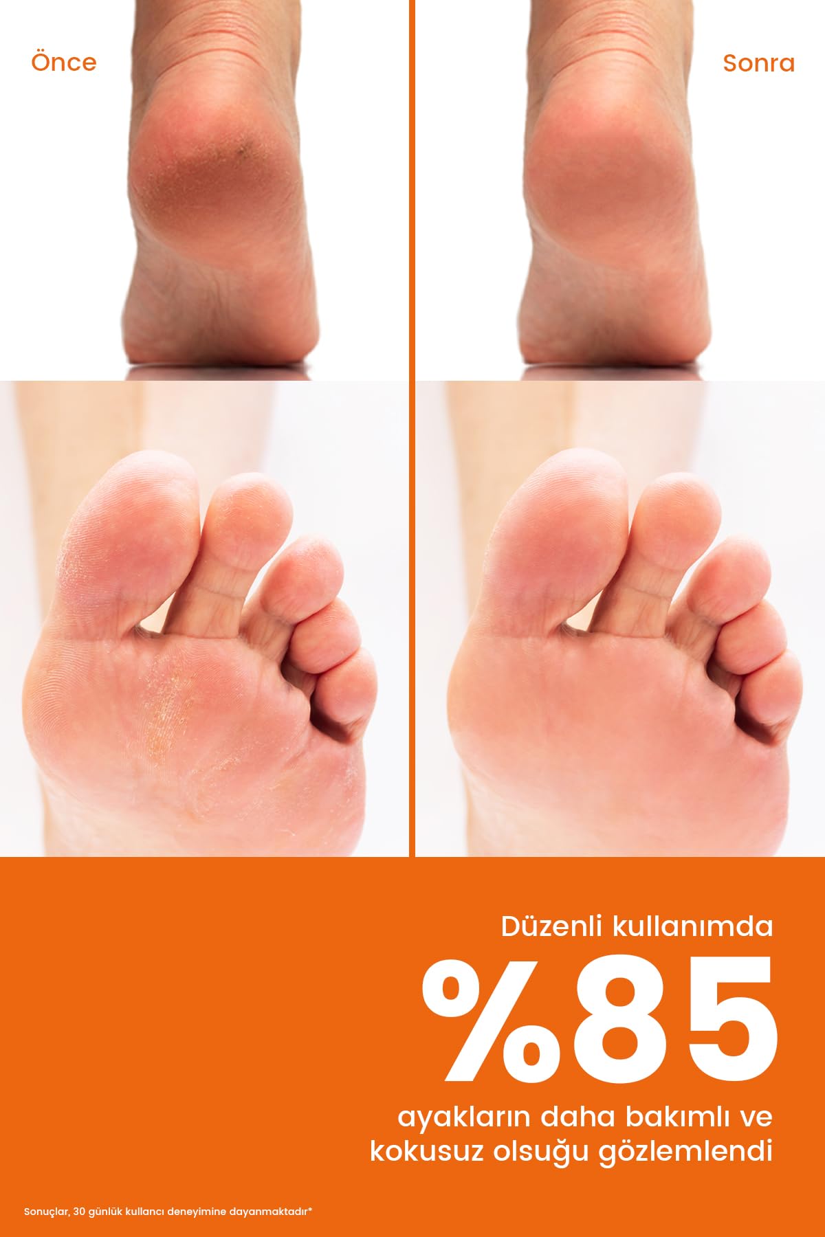 Topuk Çatlak Bakım Spreyi 250ml - Peeling, Koku Giderici, Nemlendirici, Ayak Bakım