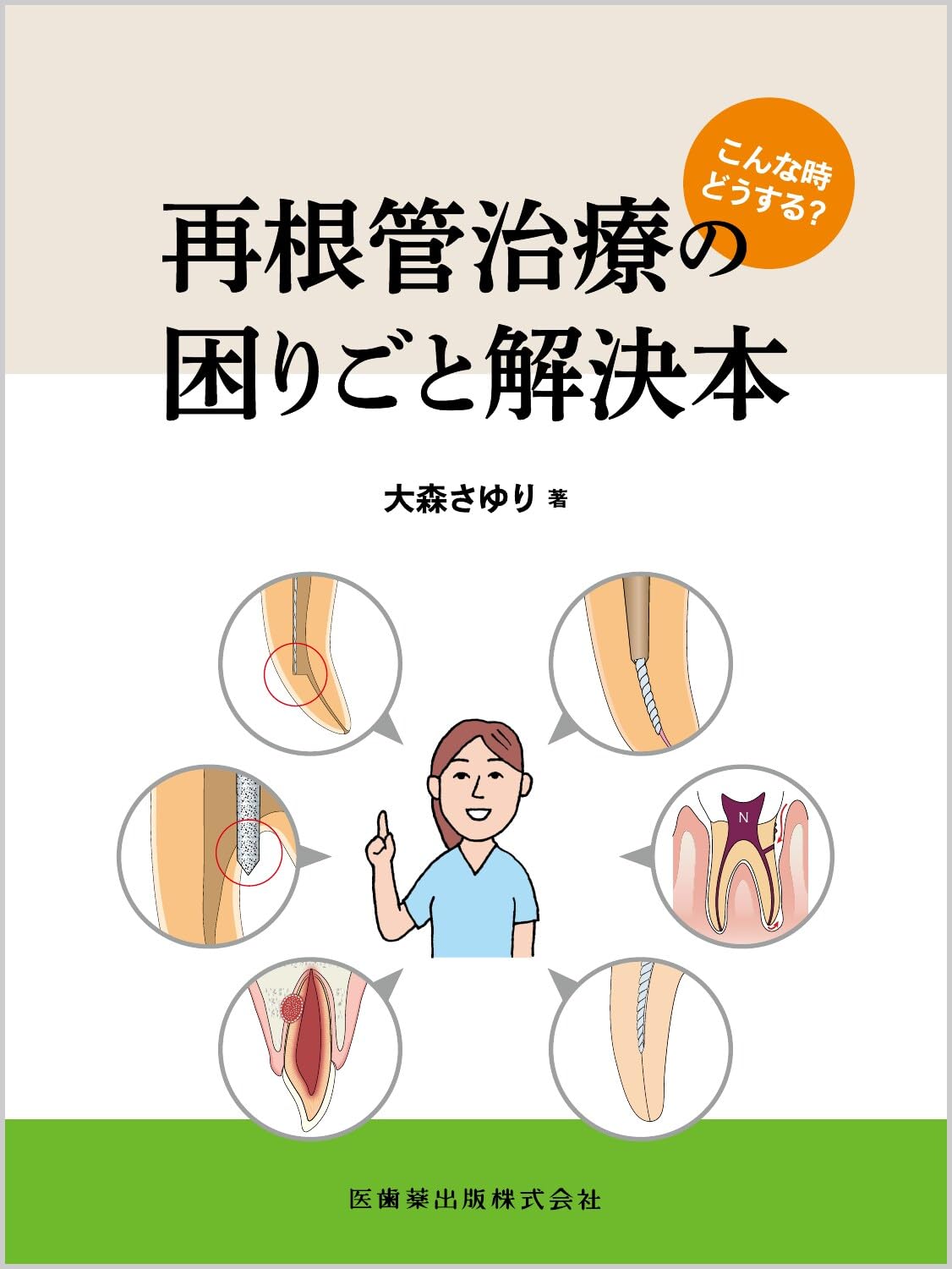 根管治療トラブル攻略本 完全解説 根管治療トラブル攻略本: エンドのよくある24の難局面大攻略