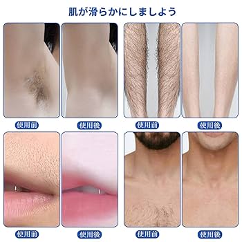 Amazon.co.jp: Vinteky ワックスウォーマー 脱毛ワックス