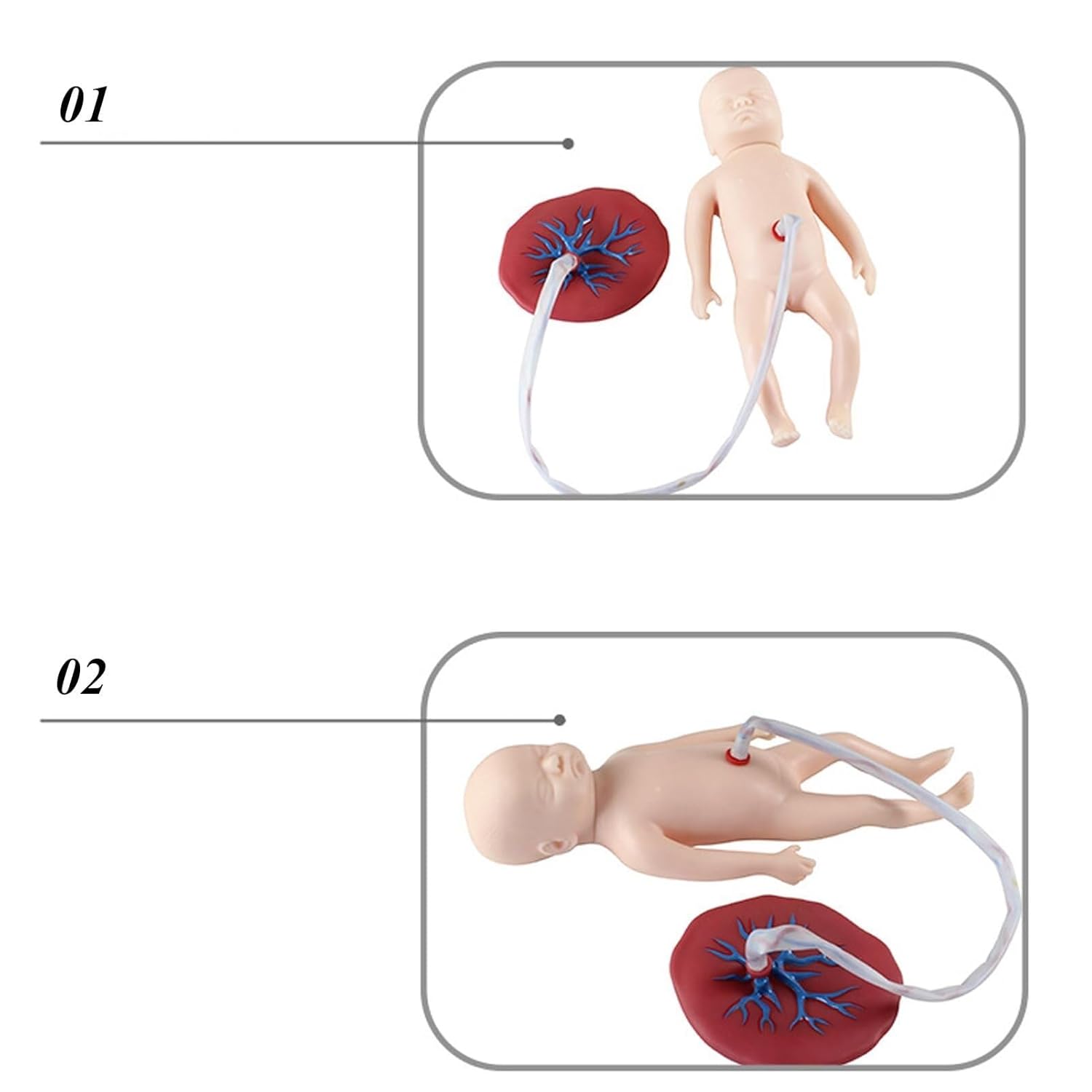 Neonatal Umbilical Cord Placenta Model Baby Manikin with Umbilical Cord and Placenta, for Obstetrics and Gynecology Teaching Tool