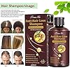Hair-Growth-Shampoo-Hair-Thickening-Shampoo-Anti-Hair-Loss-Shampoo-Helps-Stop-Hair-Loss-Regrowth-Hair-Shampoo-Grow-Hair-Fast-Hair-Loss-Treatment-for-Men-Women220mL Hair Growth Shampoo, Hair Thickening Shampoo, Anti Hair Loss Shampoo, Helps Stop Hair Loss, Regrowth Hair Shampoo, Grow Hair Fast, Hair Loss Treatment for Men & Women(220mL)