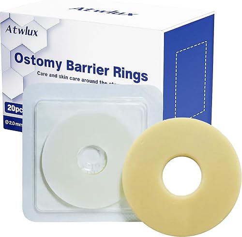 20 anillos de barrera para ostomía, suministros de ostomía hidrocoloide médica, anillo de ostomía moldeable, anillos extensores de piel sin fugas,