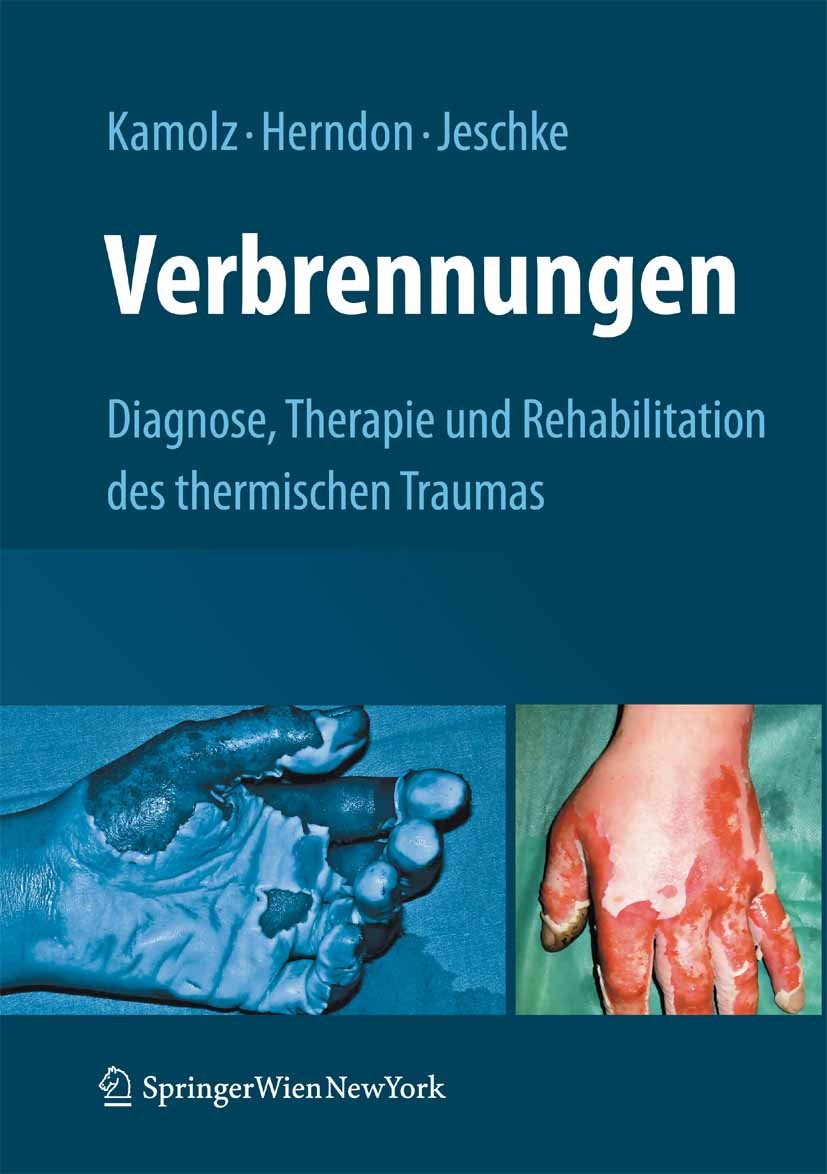 Verbrennungen: Diagnose, Therapie und Rehabilitation des thermischen Traumas