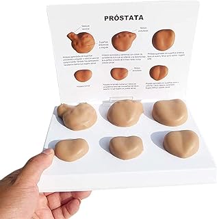 Study Model Male Contrast Pathological Pathological Prostate Anatomy Model - Prostate Anatomical Model Human Organ Study & Teaching Anatomical Models- for Medical Educational Training Aid SaiFei