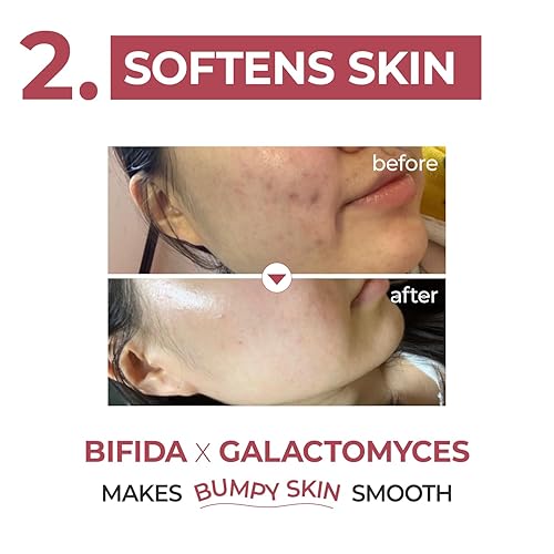 Miniatura 7 de numbuzin No.3 Suero suavizante de la piel  Cuidado de poros, piel texturizada, bifida, galactomyces, niacinamida, adenosina, pantenol  Cuidado