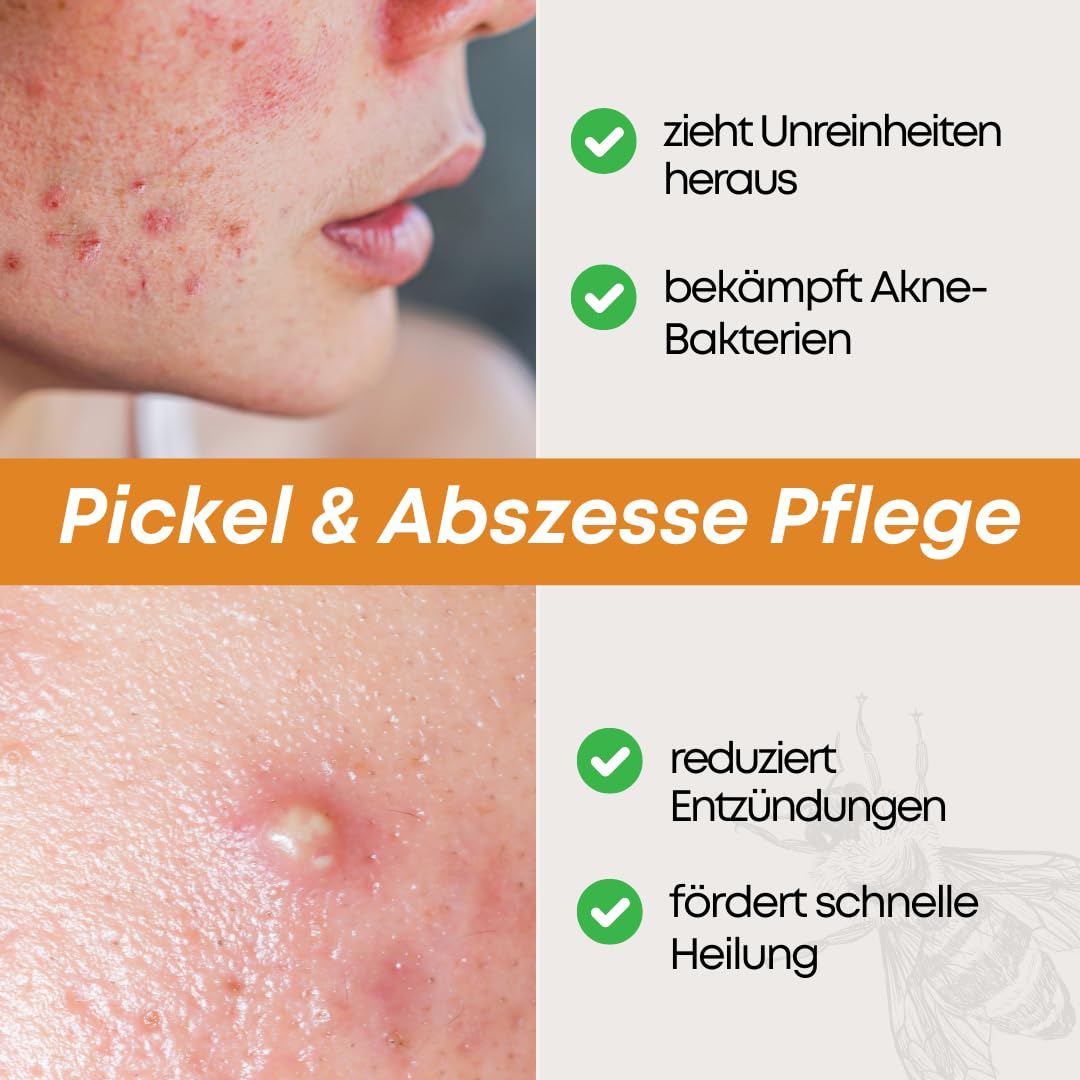 Zugsalbe & Wundsalbe 60g | Wund und Heilsalbe mit Calendula | Mighty Propolis Salbe | Wundheilsalbe | Salbe Gegen Juckreiz | Bee Enriched