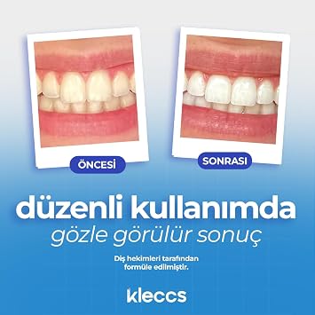 Diş Beyazlatma Bandı, Profesyonel Beyazlık, 14 Paket-28 Bant, Profesyonel Diş Beyazlatma Bandı, Günlük ve Bireysel Kullanıma Uygun