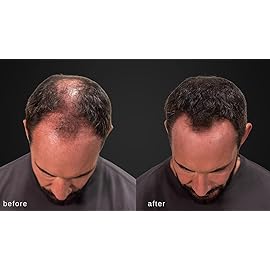 LUXE Hair Building Fibers - Thickening Fibers - CONFIDENCE IN A JAR - 2 Months+ Supply! - Hypoallergenic, Dermatologist Tested - Multiple Colors Available (Auburn)