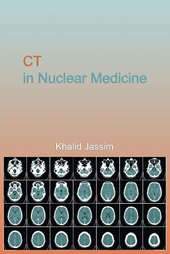 CT in Nuclear Medicine: CT in Nuclear Medicine for Technologists