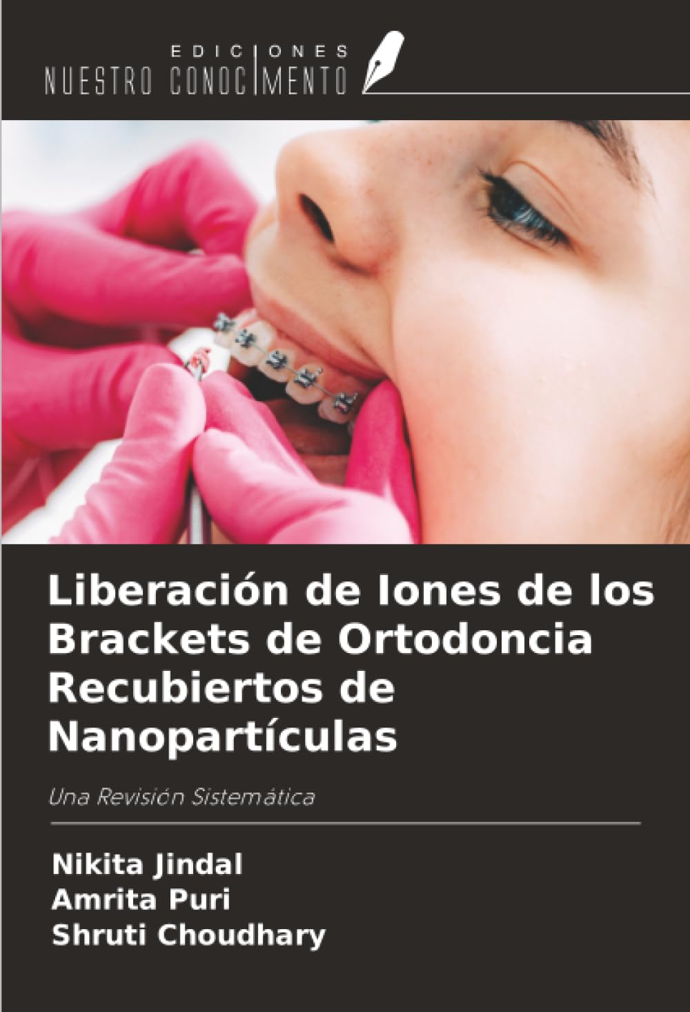 Liberación de Iones de los Brackets de Ortodoncia Recubiertos de Nanopartículas: Una Revisión Sistemática