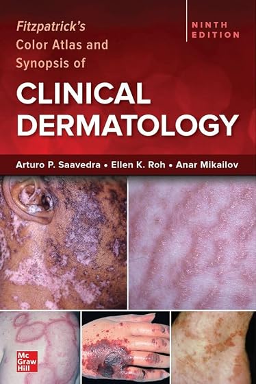Fitzpatrick's Color Atlas and Synopsis of Clinical Dermatology, Ninth