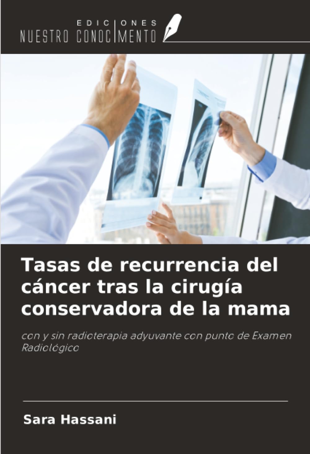 Tasas de recurrencia del cáncer tras la cirugía conservadora de la mama: con y sin radioterapia adyuvante con punto de Examen Radiológico