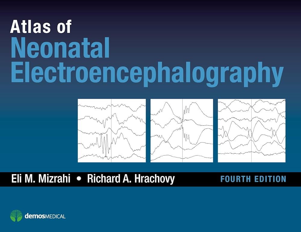 Atlas of Neonatal Electroencephalography: 9781620700679