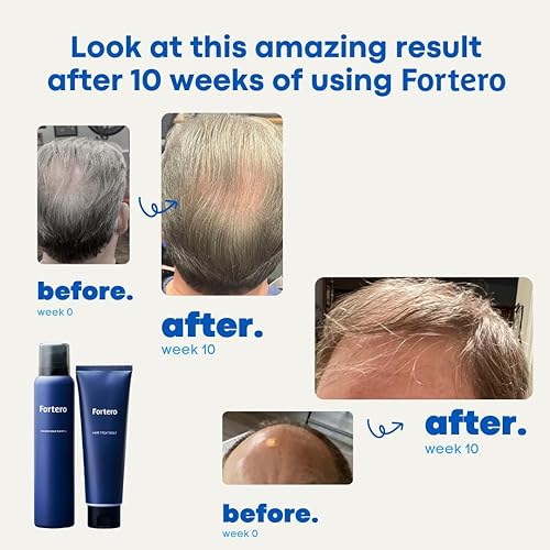 Miniatura 2 de Fortero Carbonic Acid Shampoo, Promotes Healthy, Fuller &amp; Thick Hair Growth for Men, Anti-thinning Hair Shampoo, All-natural ingredients - For All
